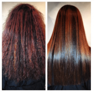 gallerysmoothingtreatment2main